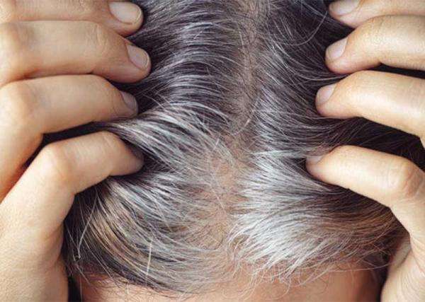 آیا موی سفید رنگ می گیرد؟